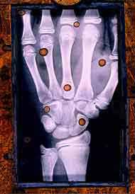 Hand X-Ray 2