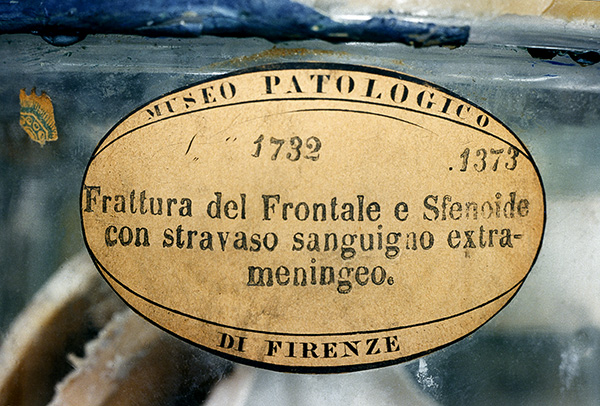 Label from Museo Patologico